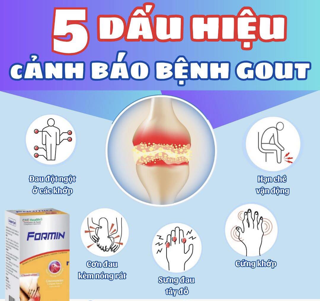 KHỚP ĐAU BẤT THƯỜNG – CẢNH GIÁC VỚI GOUT!